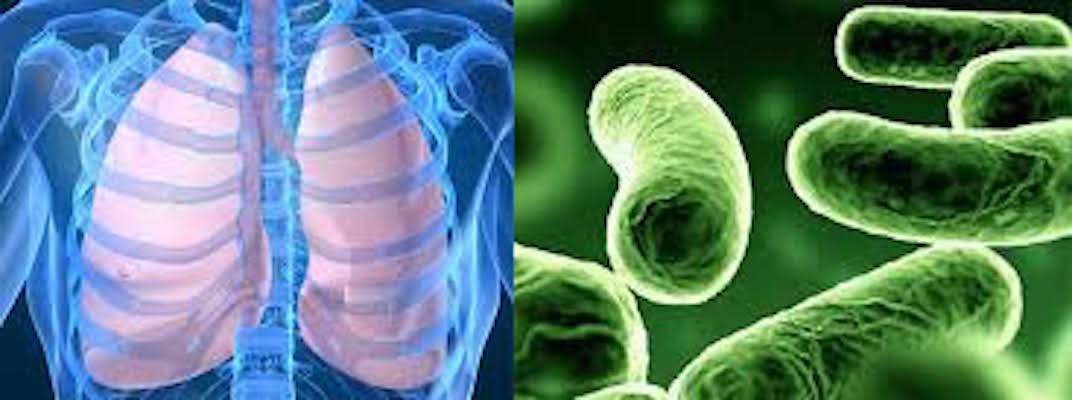 legionella